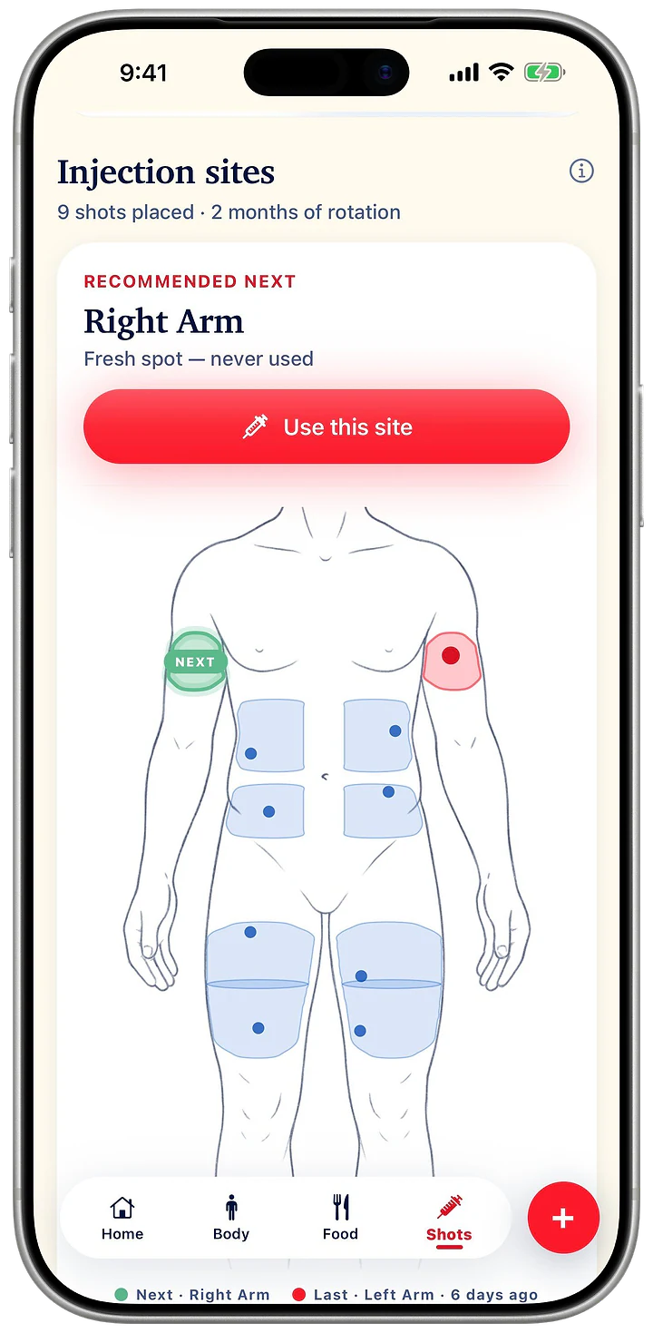 Injection sites: nine shots placed over two months, and the site recommended next, a fresh spot never used.